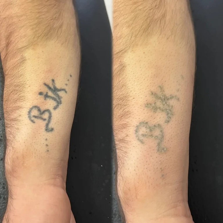 tattooed forearms showing fading tattoos
